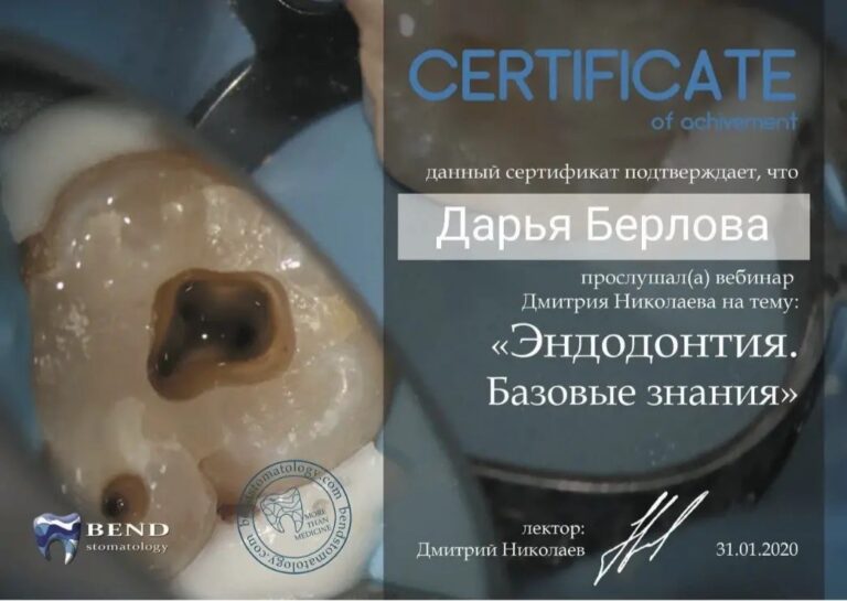 Эндодонтия. Базовые знания — Берлова Дарья Константиновна